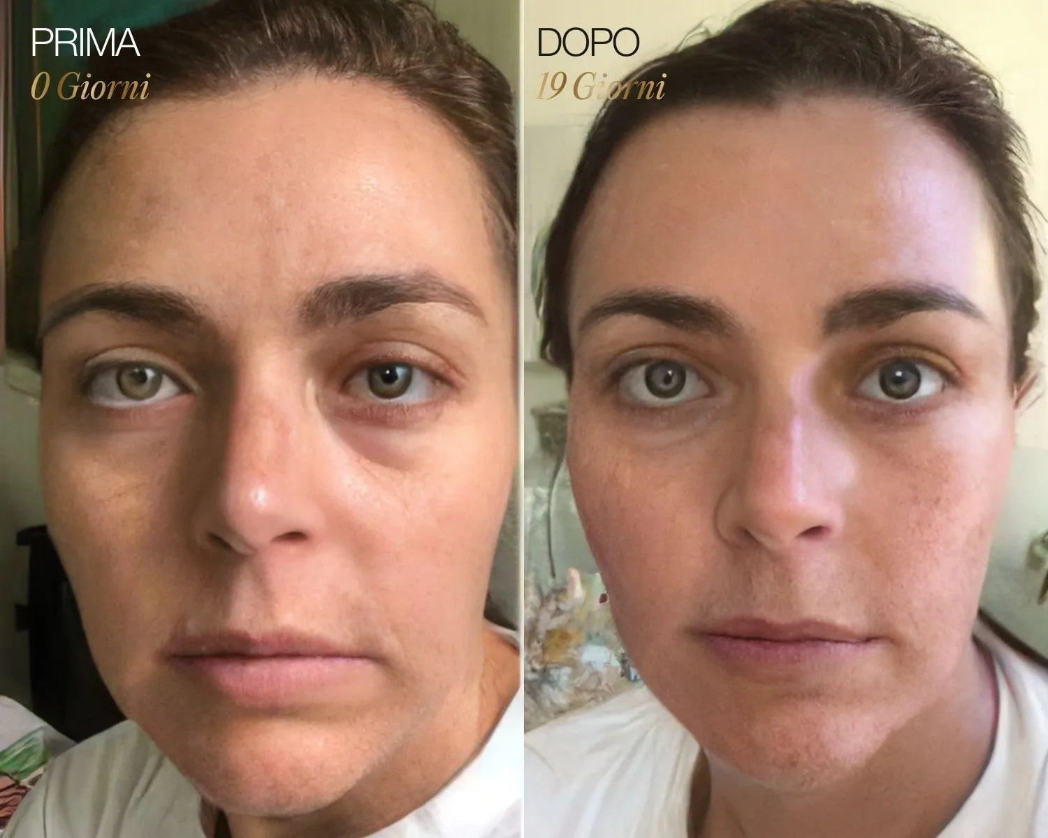 NOMI™ | Spazzola per il viso linfatica