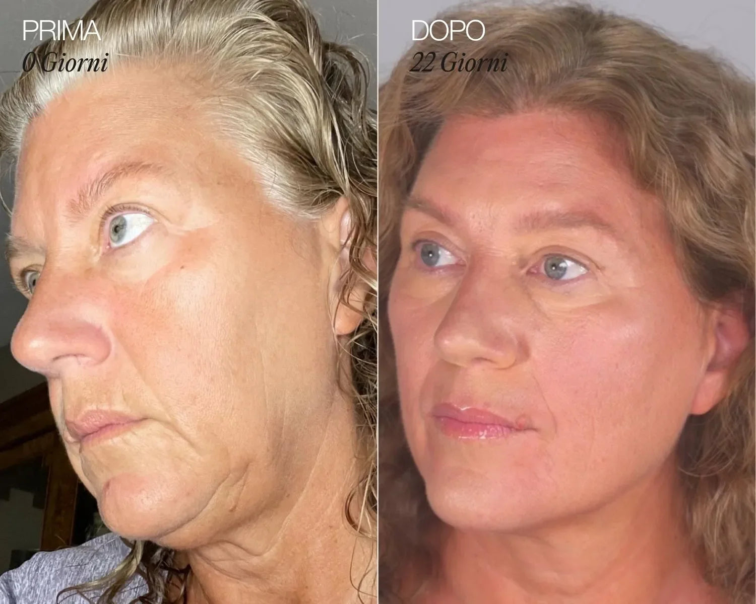 NOMI™ | Spazzola per il viso linfatica