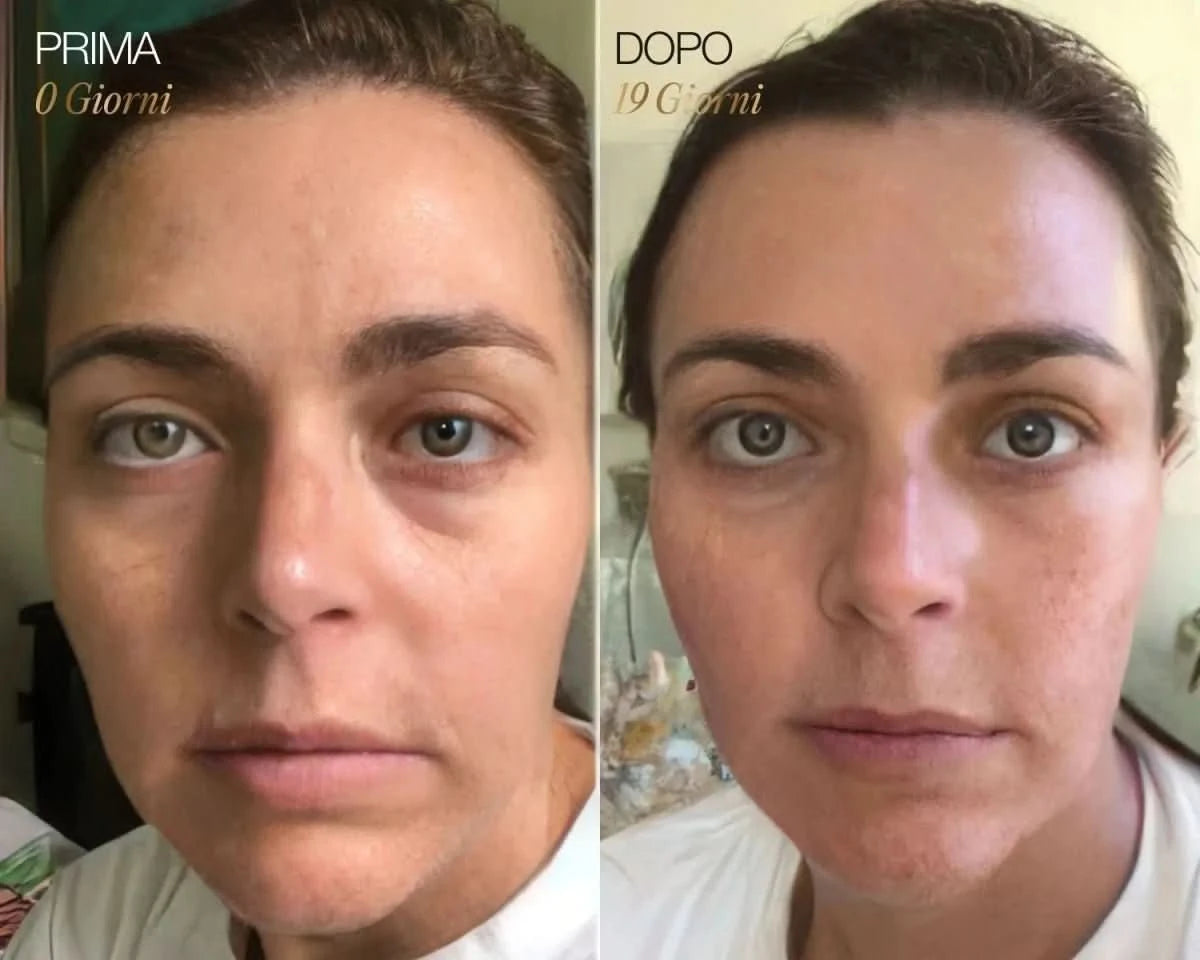 NOMI™ | Spazzola per il viso linfatica GRATIS - Nomi