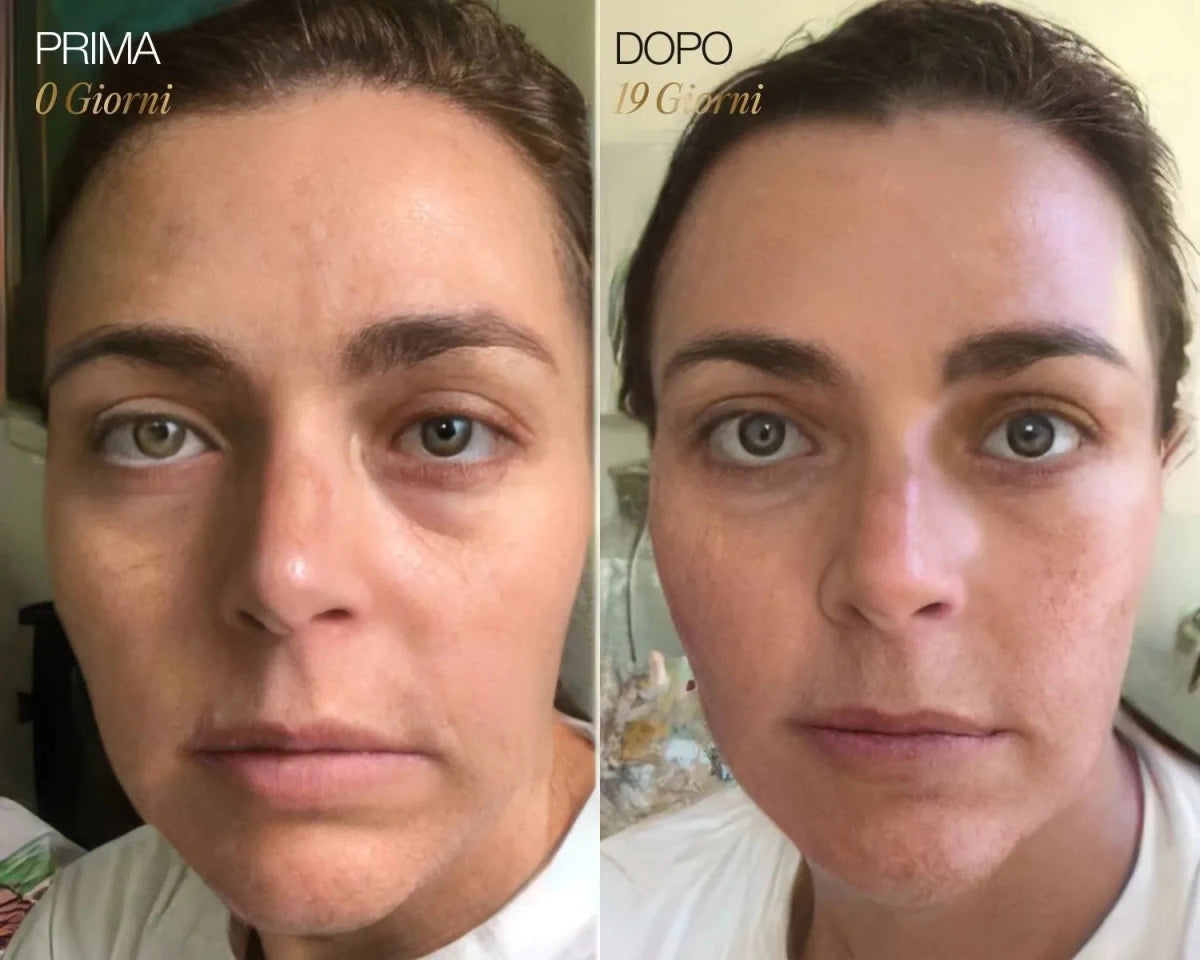 NOMI™ | Spazzola per il viso linfatica GRATIS - Nomi
